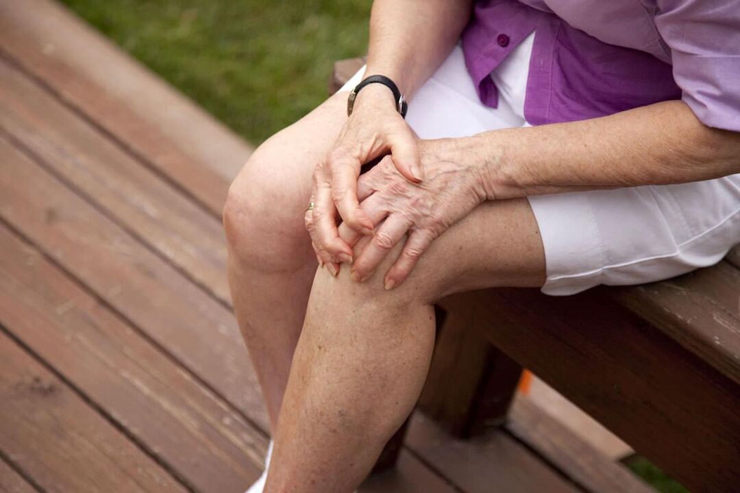 Kelio sąnario artrozė yra dažna vyresnio amžiaus moterims