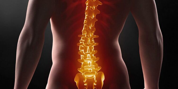Nepakeliamas skausmas apatinėje nugaros dalyje – III juosmens osteochondrozės stadijos simptomas