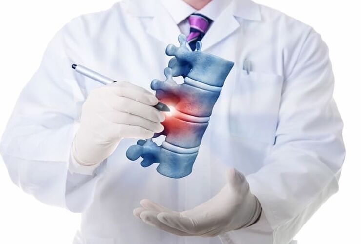 stuburo pažeidimai dėl krūtinės ląstos osteochondrozės
